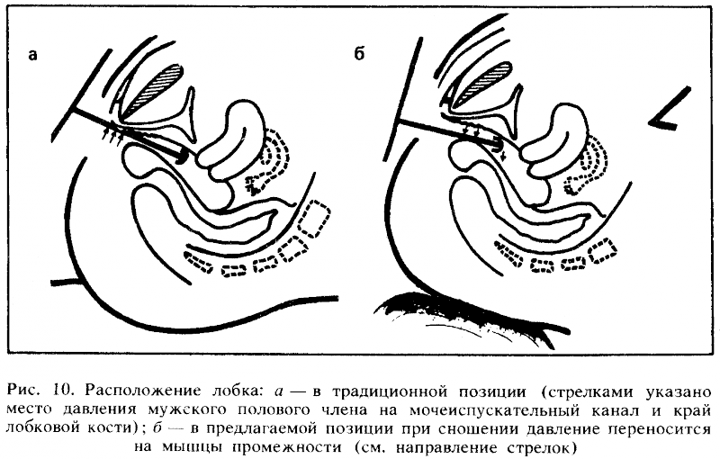 Искусство любви - _10.png