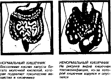 Соль здоровья – в кислой капусте без соли! - any2fbimgloader0.png